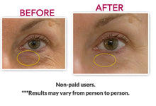 Eyeseryl®-Eye Bag Removing Ingredient Eyeseryl® 100% Solution Booster. Add To Your Own Gel or Serum.