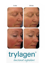 Telangyn® 100% Solution Booster Decrease Skin Redness & Inflammation, DIY Add To Your Own Skin Care.